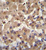 Immunohistochemical analysis of formalin-fixed, paraffin-embedded Human liver tissue labeling PRAMEF6 with ab170425 at 1/10 dilution followed by peroxidase-conjugated secondary antibody and DAB staining.