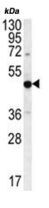 Anti-PRAMEF8 antibody - C-terminal (ab170710) at 1/100 dilution + NCI-H460 cell line lysate at 35 µgdeveloped using the ECL technique