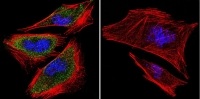 Immunofluorescent analysis of PRC1 using PRC1 Monoclonal Antibody (16F2) (ab119338 ) shows staining in A2058 Cells. PRC1 (green), F-Actin staining with Phalloidin (red) and nuclei with DAPI (blue) is shown. Cells were grown on chamber slides and fixed with formaldehyde prior to staining. Cells were probed without (control) or with an antibody recognizing PRC1 (ab119338 ) at a dilution of 1:100 over night at 4 oC, washed with PBS and incubated with a DyLight-488 conjugated secondary antibody. Images were taken at 60X magnification.