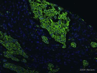 ab51248 staining PRC1 in human breast cancer cells by ICC/IF. The cells were paraformaldehyde fixed and blocked in 1% serum for 1 hour at 37°C without permeation step. The primary antibody was diluted 1/100 (PBS) and incubated with sample for 1 hour at 20°C. An Alexa Fluor® 488 conjugated donkey polyclonal to rabbit IgG, diluted 1/200 was used as secondary.See Abreview