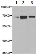 All lanes : Anti-PRDM14 antibody (ab187881) at 1/500 dilutionLane 1 : BT474 cell extractLane 2 : Jurkat cell extractLane 3 : HeLa cell extract