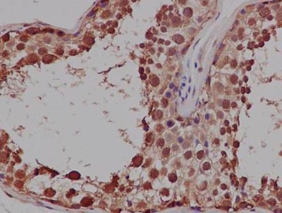 Immunohistochemistry (Formalin/PFA-fixed paraffin-embedded sections) analysis of Human testis tissue labelling PRDM1/PFM1 with ab156867 at 1/500. An ImmunoHistoprobe (Ready to use) HRP polymer for Rabbit IgG was used as the secondary antibody. Tissue was counterstained with Hematoxylin.