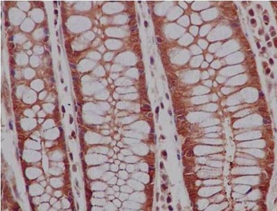 Immunohistochemistry (Formalin/PFA-fixed paraffin-embedded sections) analysis of Human colon tissue labelling PRDM1/PFM1 with ab156867 at 1/500. An ImmunoHistoprobe (Ready to use) HRP polymer for Rabbit IgG was used as the secondary antibody. Tissue was counterstained with Hematoxylin.
