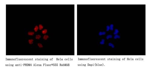 Immunocytochemistry/Immunofluorescence analysis of HeLa cells labelling PRDM4/PFM1 with ab156867 at 1/250. Cells were fixed with 4% paraformaldehyde. An Alexa Fluor® 555-conjugtaed goat anti-rabbit IgG (1/200) was used as the secondary antibody. Counterstained with DAPI.
