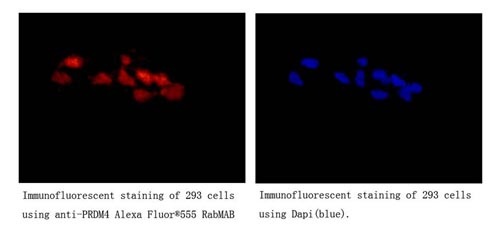Immunocytochemistry/Immunofluorescence analysis of 293 cells labelling PRDM4/PFM1 with ab156867 at 1/250. Cells were fixed with 4% paraformaldehyde. An Alexa Fluor® 555-conjugtaed goat anti-rabbit IgG (1/200) was used as the secondary antibody. Counterstained with DAPI.