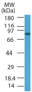 Anti-PRDM5 antibody (ab47066) at 1 µg/ml + HL60 cell lysate.