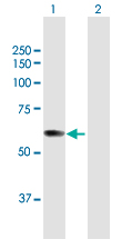 All lanes : Anti-pre-mRNA cleavage factor I (59 kDa subunit) antibody (ab169626) at 1 µg/mlLane 1 : pre-mRNA cleavage factor I (59 kDa subunit) transfected 293T cell lysateLane 2 : Non-transfected 293T cell lysateLysates/proteins at 15 µl per lane.developed using the ECL technique