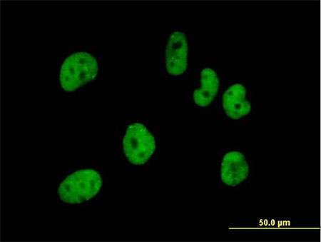 Immunofluorescent analysis of HeLa cells labeling pre-mRNA cleavage factor I (59 kDa subunit) with ab169626 at 10 µg/ml.