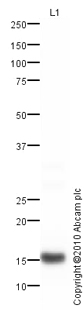 Anti-Prealbumin antibody (ab78548) at 1 µg/ml + Human Plasma Total Protein Lysate at 10 µgSecondaryGoat polyclonal to Rabbit IgG - H&L - Pre-Adsorbed (HRP) at 1/3000 dilutiondeveloped using the ECL techniquePerformed under reducing conditions.