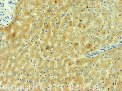 IHC image of Prealbumin staining in Human Normal Liver FFPE section, performed on a BondTM system using the standard protocol F. The section was pre-treated using heat mediated antigen retrieval with sodium citrate buffer (pH6, epitope retrieval solution 1) for 20 mins. The section was then incubated with ab78548, 1µg/ml, for 15 mins at room temperature and detected using an HRP conjugated compact polymer system. DAB was used as the chromogen. The section was then counterstained with haematoxylin and mounted with DPX