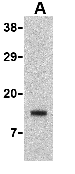 Anti-Noxa antibody (ab36833) at 0.5 µg/ml + Human stomach cell lysate