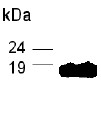 Anti-Prealbumin antibody (ab26925) at 1/2000 dilution + Plasma proteinSecondaryGoat anti-IgY-HRP