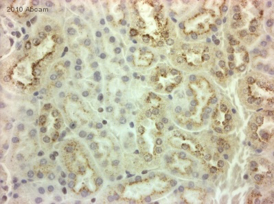ab71181 staining Presenilin 1 mouse kidney tissue section by Immunohistochemistry (Formalin/ PFA fixed paraffin-embedded tissue sections). Tissue underwent fixation in formaldehyde, heat mediated antigen retrieval and blocking (5 minutes/peroxidase block and 10 minutes/protein block) for 15 minutes at 200C. The primary antibody was diluted 1/2000 and incubated with the sample for 45 minutes at 200C. A HRP conjugated goat polyclonal to rabbit IgG was used undiluted as secondary antibody.See Abreview
