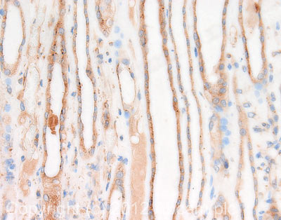 IHC image of Presenilin 1 staining in human kidney formalin fixed paraffin embedded tissue section, performed on a Leica BondTM system using the standard protocol F. The section was pre-treated using heat mediated antigen retrieval with sodium citrate buffer (pH6, epitope retrieval solution 1) for 20 mins. The section was then incubated with ab71181, 1µg/ml, for 15 mins at room temperature and detected using an HRP conjugated compact polymer system. DAB was used as the chromogen. The section was then counterstained with haematoxylin and mounted with DPX. For other IHC staining systems (automated and non-automated) customers should optimize variable parameters such as antigen retrieval conditions, primary antibody concentration and antibody incubation times.