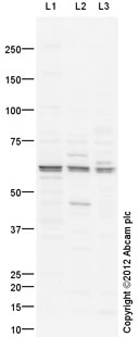 All lanes : Anti-Presenilin 1 antibody (ab71181)Lane 1 : Liver (Mouse) Tissue Lysate Lane 2 : Kidney (Mouse) Tissue Lysate Lane 3 : Kidney (Rat) Tissue LysateLysates/proteins at 10 µg per lane.SecondaryGoat Anti-Rabbit IgG H&L (HRP) preadsorbed (ab97080) at 1/5000 dilutiondeveloped using the ECL techniquePerformed under reducing conditions.