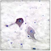 ab53717, at a 1/50 dilution, staining Human Presenilin 1 by Immunohistochemistry in mouse brain brain paraffin embedded tissue,