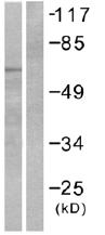All lanes : Anti-Presenilin 1 antibody (ab53717) at 1/500 dilutionLane 1 : Extracts from mouse heart cellsLane 2 : Extracts from mouse heart cells, plus immunizing peptide