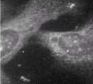 IF staining PS1 using ab15456.