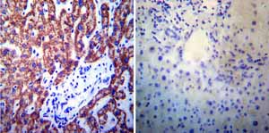 Immunohistochemistry was performed on normal biopsies of deparaffinized Human liver tissue. To expose target proteins heat induced antigen retrieval was performed using 10mM sodium citrate (pH6.0) buffer microwaved for 8-15 minutes. Following antigen retrieval tissues were blocked in 3% BSA-PBS for 30 minutes at room temperature. Tissues were then probed at a dilution of 1:200 with a mouse monoclonal antibody recognizing Presenilin 1 ab15456 or without primary antibody (negative control) overnight at 4°C in a humidified chamber. Tissues were washed extensively with PBST and endogenous peroxidase activity was quenched with a peroxidase suppressor. Detection was performed using a biotin-conjugated secondary antibody and SA-HRP followed by colorimetric detection using DAB. Tissues were counterstained with hematoxylin and prepped for mounting.