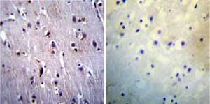 Immunohistochemistry was performed on normal biopsies of deparaffinized Human brain tissue. To expose target proteins heat induced antigen retrieval was performed using 10mM sodium citrate (pH6.0) buffer microwaved for 8-15 minutes. Following antigen retrieval tissues were blocked in 3% BSA-PBS for 30 minutes at room temperature. Tissues were then probed at a dilution of 1:20 with a mouse monoclonal antibody recognizing Presenilin 1 ab15456 or without primary antibody (negative control) overnight at 4°C in a humidified chamber. Tissues were washed extensively with PBST and endogenous peroxidase activity was quenched with a peroxidase suppressor. Detection was performed using a biotin-conjugated secondary antibody and SA-HRP followed by colorimetric detection using DAB. Tissues were counterstained with hematoxylin and prepped for mounting.