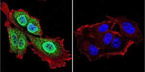 Immunofluorescent analysis of Presenilin 1 using Presenilin 1 Monoclonal antibody (APS 18) ab115458 shows staining in MCF-7 cells. Presenilin 1 staining (green) F-Actin staining with Phalloidin (red) and nuclei with DAPI (blue) is shown. Cells were grown on chamber slides and fixed with formaldehyde prior to staining. Cells were probed without (control) or with or an antibody recognizing Presenilin 1 ab115458 at a dilution of 1:20-1:100 over night at 4 ?C washed with PBS and incubated with a DyLight-488 conjugated secondary antibody. Images were taken at 60X magnification.