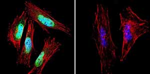 Immunofluorescent analysis of Presenilin 1 using Presenilin 1 Monoclonal antibody (APS 18) ab115458 shows staining in A2058 melanoma cells. Presenilin 1 staining (green) F-Actin staining with Phalloidin (red) and nuclei with DAPI (blue) is shown. Cells were grown on chamber slides and fixed with formaldehyde prior to staining. Cells were probed without (control) or with or an antibody recognizing Presenilin 1 ab115458 at a dilution of 1:20-1:100 over night at 4 ?C washed with PBS and incubated with a DyLight-488 conjugated secondary antibody. Images were taken at 60X magnification.