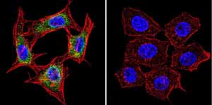 Immunofluorescent analysis of Presenilin 1 using Presenilin 1 Monoclonal antibody (APS 18) ab115458 shows staining in HeLa cells. Presenilin 1 staining (green) F-Actin staining with Phalloidin (red) and nuclei with DAPI (blue) is shown. Cells were grown on chamber slides and fixed with formaldehyde prior to staining. Cells were probed without (control) or with or an antibody recognizing Presenilin 1 ab115458 at a dilution of 1:20-1:100 over night at 4 ?C washed with PBS and incubated with a DyLight-488 conjugated secondary antibody. Images were taken at 60X magnification.