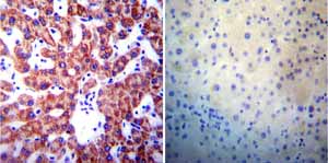 Immunohistochemistry was performed on normal biopsies of deparaffinized Human liver tissue. To expose target proteins heat induced antigen retrieval was performed using 10mM sodium citrate (pH6.0) buffer microwaved for 8-15 minutes. Following antigen retrieval tissues were blocked in 3% BSA-PBS for 30 minutes at room temperature. Tissues were then probed at a dilution of 1:200 with a mouse monoclonal antibody recognizing Presenilin 1 ab15458 or without primary antibody (negative control) overnight at 4°C in a humidified chamber. Tissues were washed extensively with PBST and endogenous peroxidase activity was quenched with a peroxidase suppressor. Detection was performed using a biotin-conjugated secondary antibody and SA-HRP followed by colorimetric detection using DAB. Tissues were counterstained with hematoxylin and prepped for mounting.