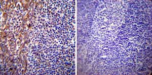 Immunohistochemistry was performed on normal biopsies of deparaffinized Human tonsil tissue. To expose target proteins heat induced antigen retrieval was performed using 10mM sodium citrate (pH6.0) buffer microwaved for 8-15 minutes. Following antigen retrieval tissues were blocked in 3% BSA-PBS for 30 minutes at room temperature. Tissues were then probed at a dilution of 1:20 with a mouse monoclonal antibody recognizing Presenilin 1 ab15458 or without primary antibody (negative control) overnight at 4°C in a humidified chamber. Tissues were washed extensively with PBST and endogenous peroxidase activity was quenched with a peroxidase suppressor. Detection was performed using a biotin-conjugated secondary antibody and SA-HRP followed by colorimetric detection using DAB. Tissues were counterstained with hematoxylin and prepped for mounting.