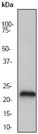 Anti-Presenilin 2 antibody [EP1515Y] (ab51249) at 1/200000 dilution + PC-12 cell lysate at 10 µgSecondaryGoat anti-rabbit HRP labeled at 1/2000 dilution