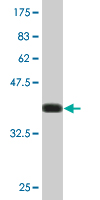 Anti-PRKACA antibody (ab76513) at 5 µg/ml + immunogen (GST-tagged recombinant fragment) at 0.2 µg/mlSecondaryGoat Anti-Mouse IgG (H&L) HRP-conjugated at 1/5000 dilution