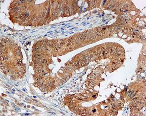 ab109523, at a 1/500 dilution, staining Human NOXA2/p67phox in colon, using Immunohistochemistry, Formalin/PFA-fixed paraffin-embedded tissue.