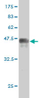 Western blot against tagged recombinant protein immunogen using ab57765 PRKRIP1 antibody at 1ug/ml.
