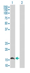 All lanes : Anti-PRKRIR antibody (ab67201)Lane 1 : PRKRIR transfected 293T cell line lysateLane 2 : Non-transfected 293T cell line lysateLysates/proteins at 25 µg per lane.SecondaryGoat Anti-Mouse IgG (H&L) HRP at 1/5000 dilution