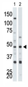 All lanes : Anti-PRKX antibody - C-terminal (ab71619) at 1/100 dilutionLane 1 : Jurkat cell lysateLane 2 : Mouse brain tissue lysateLysates/proteins at 12.5 µg per lane.