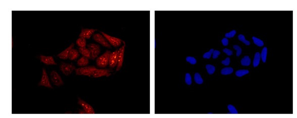 Immunofluorescent analysis of HeLa cells (-20℃ acetone-fixed) labeling PRMT7 with ab181214 at 1/250 dilution (red). Goat anti rabbit IgG (Alexa Fluor® 555) was used as a secondary antibody, at a dilution of 1/200. Counter stain: Dapi (blue).