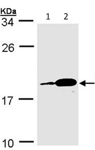 All lanes : Anti-Proapoptotic Caspase Adaptor Protein antibody (ab96308) at 1/1000 dilutionLane 1 : MOLT4 whole cell lysateLane 2 : Raji whole cell lysateLysates/proteins at 30 µg per lane.