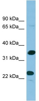 Anti-ProDynorphin antibody (ab102568) at 1 µg/ml + Hela cell lysate at 10 µg