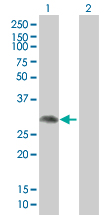 All lanes : Anti-ProDynorphin antibody (ab167543) at 1/500 dilutionLane 1 : ProDynorphin transfected 293T cell lysateLane 2 : Non-transfected 293T cell lysateLysates/proteins at 15 µl per lane.SecondaryGoat anti-Mouse IgG HRP at 1/2500 dilutiondeveloped using the ECL technique