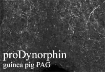ab10279, at a dilution of 1/500, staining ProDynorphin in guinea pig midbrain periaqueductal gray (PAG) section by Immunohistochemistry (PFA perfusion fixed frozen sections).