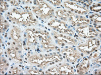 ab118984 at 1/50 dilution staining Profilin 1 in Paraffin-embedded Human Kidney tissue by Immunohistochemistry.