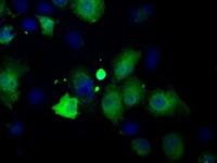 ab118984 at 1/100 dilution staining Profilin 1 in COS7 cells transiently transfected with pCMV6-ENTRY Profilin 1 by Immunofluorescence.
