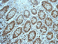 ab124904, at 1/500 dilution, staining Profilin 1 in paraffin-embedded Human colon tissue by Immunohistochemistry.