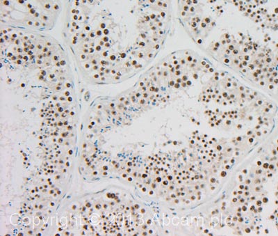 IHC image of Progesterone Receptor staining in Human Testis formalin fixed paraffin embedded tissue section, performed on a Leica Bond™ system using the standard protocol F. The section was pre-treated using heat mediated antigen retrieval with sodium citrate buffer (pH6, epitope retrieval solution 1) for 20 mins. The section was then incubated with ab131486, 1 µg/ml, for 15 mins at room temperature and detected using an HRP conjugated compact polymer system. DAB was used as the chromogen. The section was then counterstained with haematoxylin and mounted with DPX. For other IHC staining systems (automated and non-automated) customers should optimize variable parameters such as antigen retrieval conditions, primary antibody concentration and antibody incubation times.