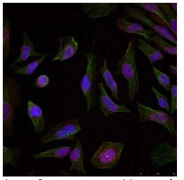 Immunoflourescent analysis of methanol-fixed HeLa cells labelling Progesterone Receptor with ab131486 at 1/100 dilution.