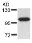 Anti-Progesterone Receptor antibody (ab131486) at 1/500 dilution + MDA435 cell extract
