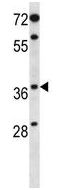 Anti-Progestin Receptor Beta antibody (ab123693) at 1/100 dilution + MDA-MB453 cell line lysate at 35 µg