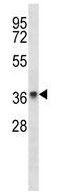 Anti-Progestin Receptor Beta antibody (ab123693) at 1/100 dilution + Mouse cerebellum tissue lysate at 35 µg