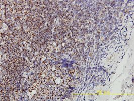 Prohibitin antibody (ab55618) used in immunohistochemistry at 5ug/ml on formalin fixed and paraffin embedded human tonsil tissue.