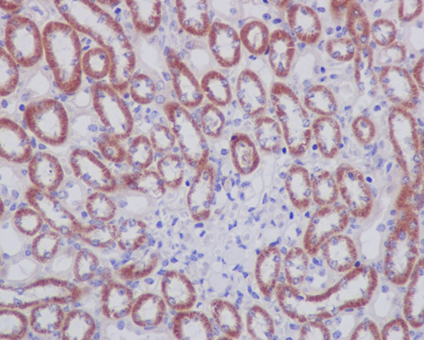 Immunohistochemistry (Formalin/PFA-fixed paraffin-embedded sections) analysis of mouse kidney tissue labelling Prohibitin with ab75766 at 1/250.